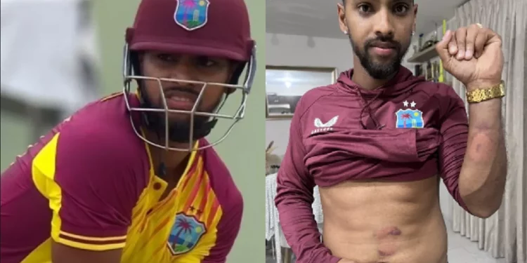 Nicholas Pooran portrays the devastating blows that Arshdeep Singh's delivery and Brandon King's shot inflicted in "The After Effects."