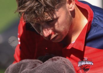 Marsh Cup: Henry Hunt is seriously hurt while playing the field