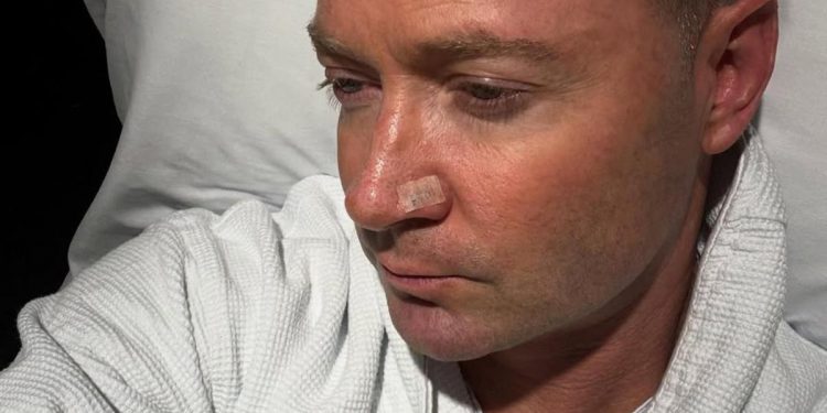 Michael Clarke diagnosed with skin cancer 1 Michael Clarke diagnosed with skin cancer